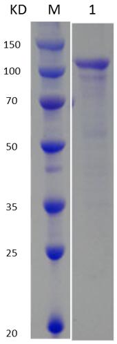 12% SDS-PAGE analysis profiles of purified MCR_RS00350-21-913 (CBB stained).
